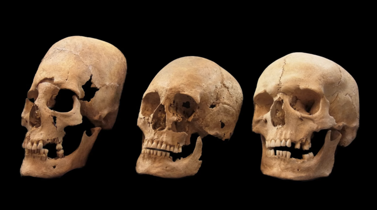 Ученые раскрыли баварскую тайну заостренных черепов
